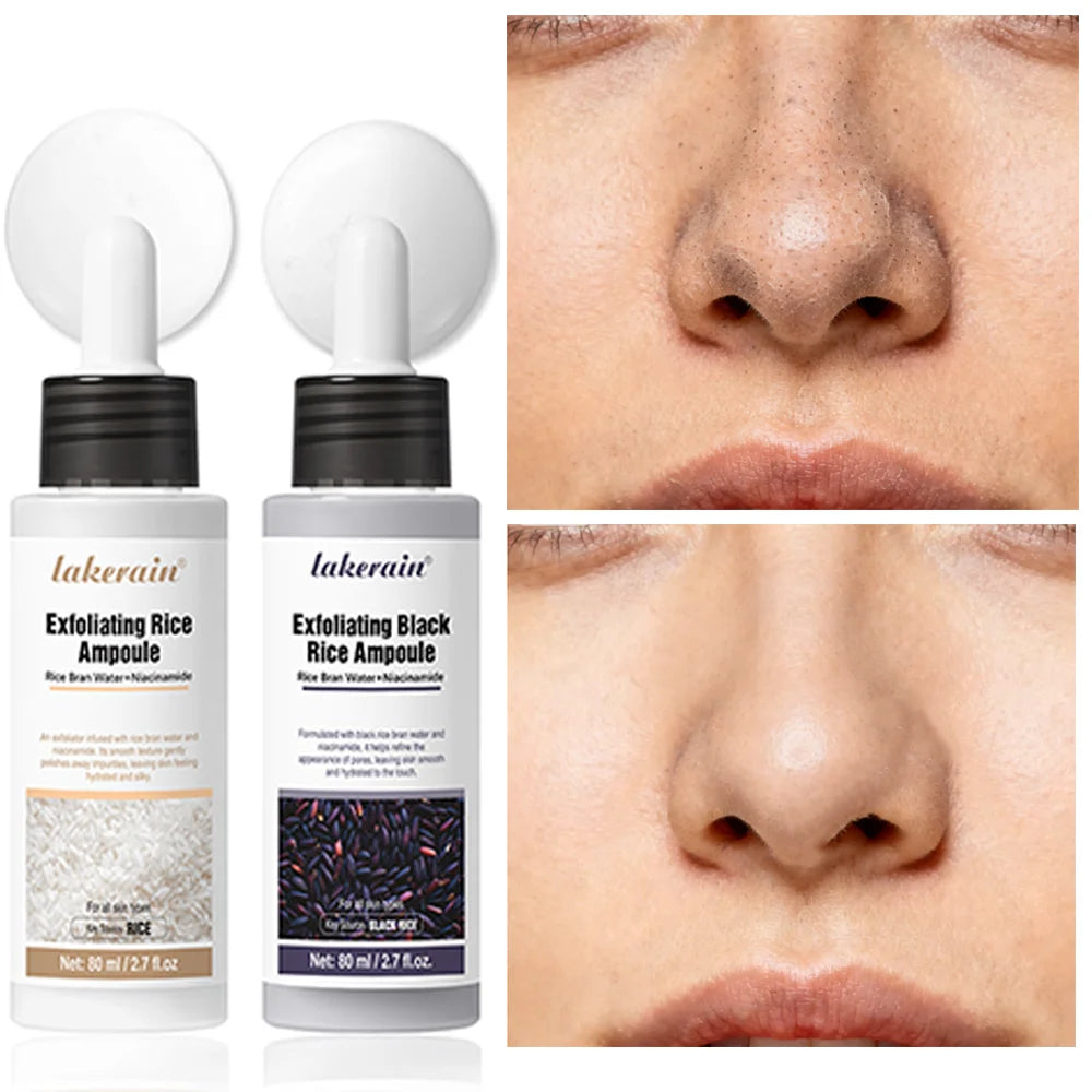Exfoliating Rice Ampoule – Gentle Peeling Gel for Smooth, Glowing Skin